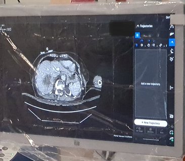 Case 1