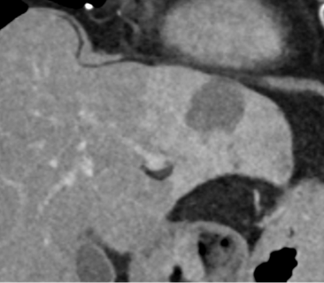 Case 6