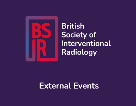 External Events